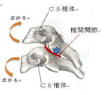 第５/第６頚椎椎間